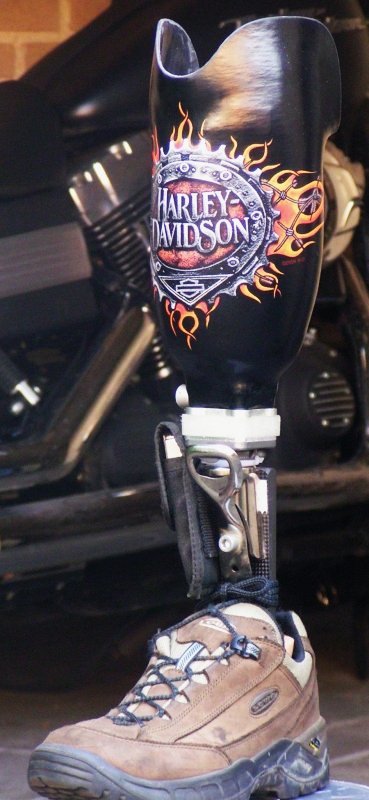new prosthesis with Harley-Davidson logo